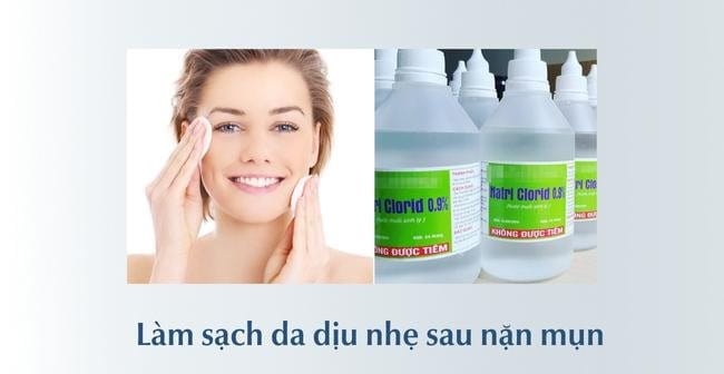 Nặn mụn xong nên làm gì để không bị thâm sẹo?