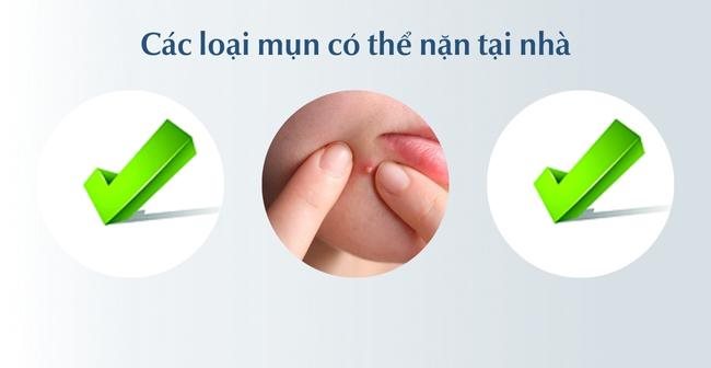 Nặn mụn xong nên làm gì để không bị thâm sẹo?