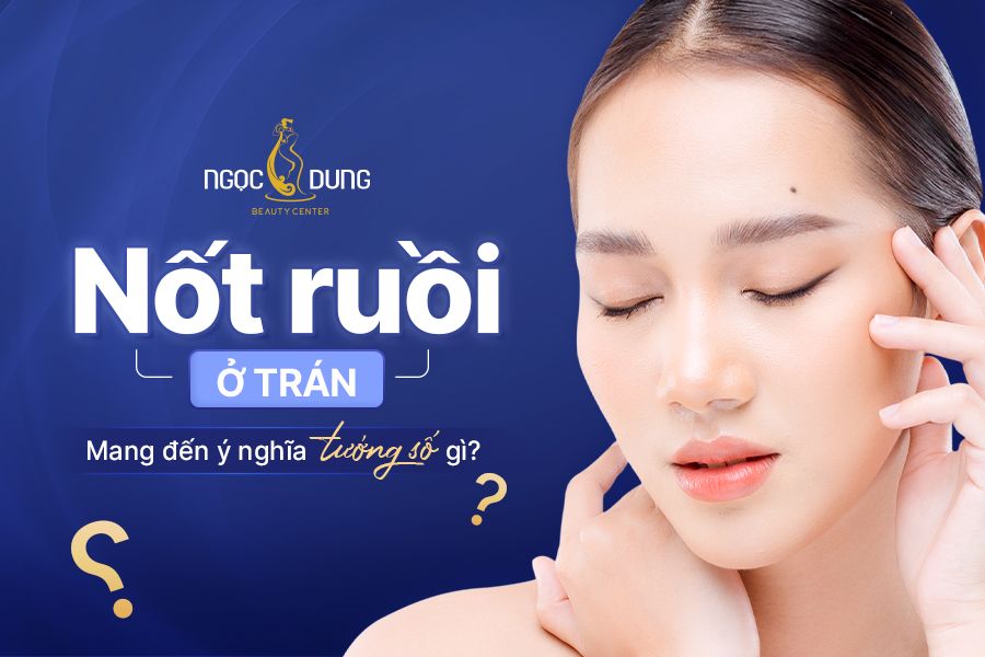 Nốt ruồi ở trán nam và nữ tốt hay xấu? Có nên tẩy không?