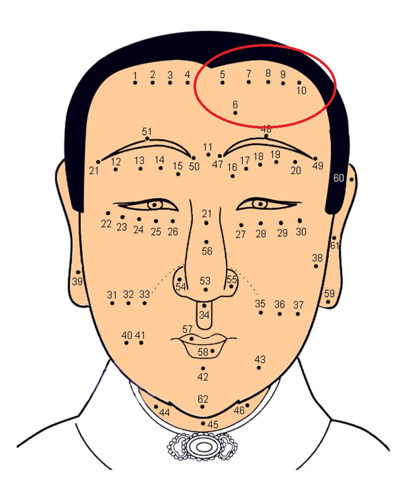 Có nốt ruồi trên trán: Không sớm thì muộn cũng gặp “chuyện’’?