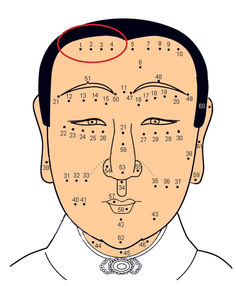 Có nốt ruồi trên trán: Không sớm thì muộn cũng gặp “chuyện’’?