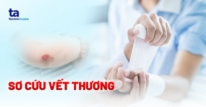 Cách sơ cứu vết thương đúng kỹ thuật với từng loại thương tổn